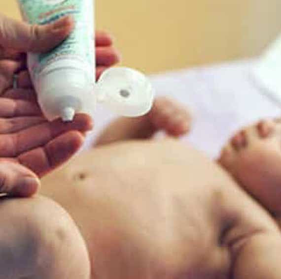 Cloth Diaper Rash Cream Recommendations - a list of good and bad diaper rash creams for cloth diapers